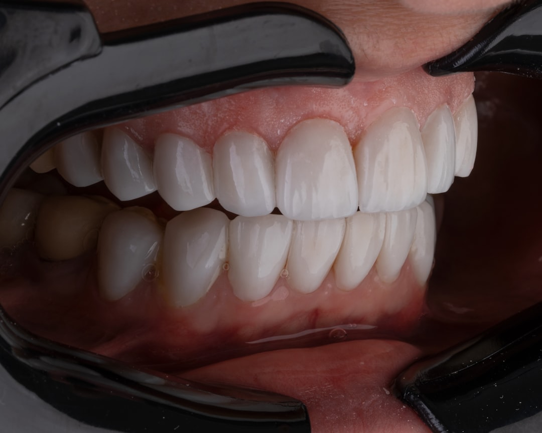 Finding the Best Dentist in Tijuana for Your Dental Needs